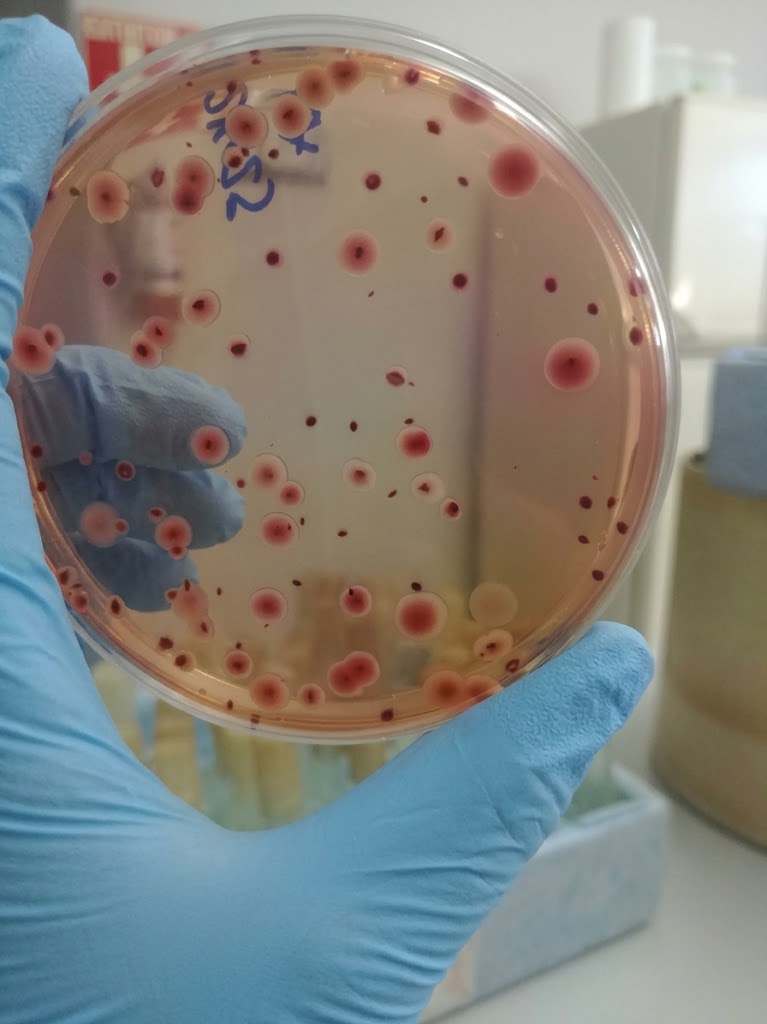 Envases estériles y material para muestreo de alimentos